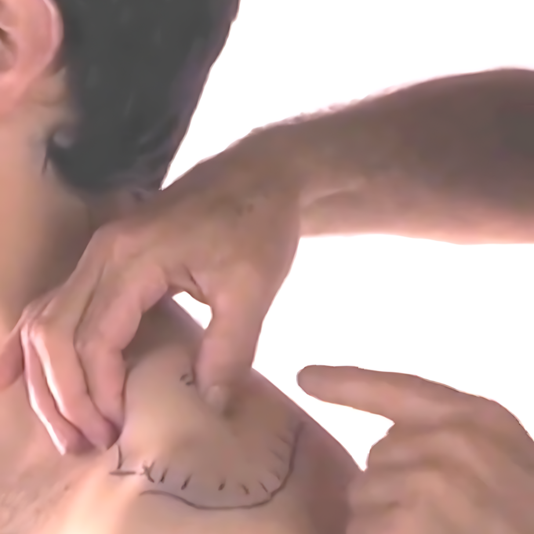 Tension Headache and Trigger Points (4 hrs)