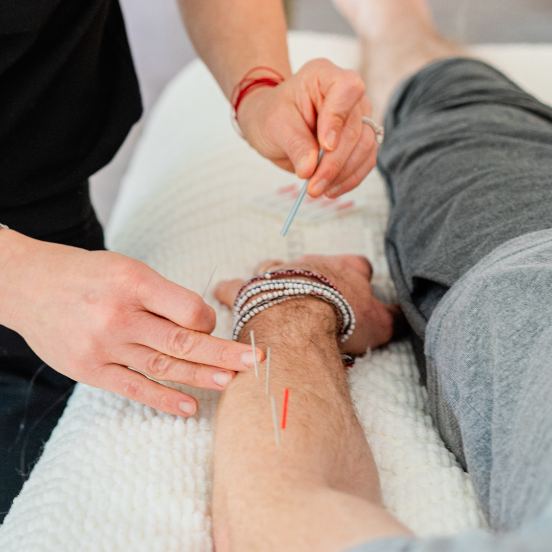 Foundation in Acupuncture L1 & L2