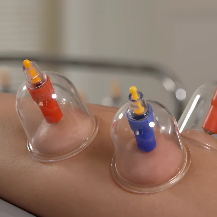 Massage Cupping Therapy (7 hrs)