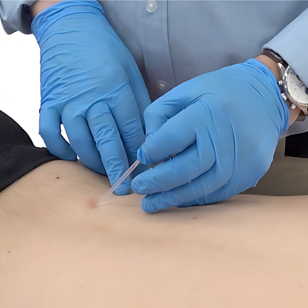 Trigger Point Dry Needling - IMS (18 hrs)