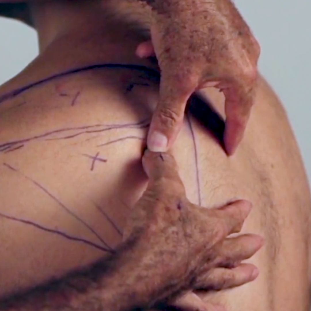 NAT Treating the Rotator Cuff (4 hrs)