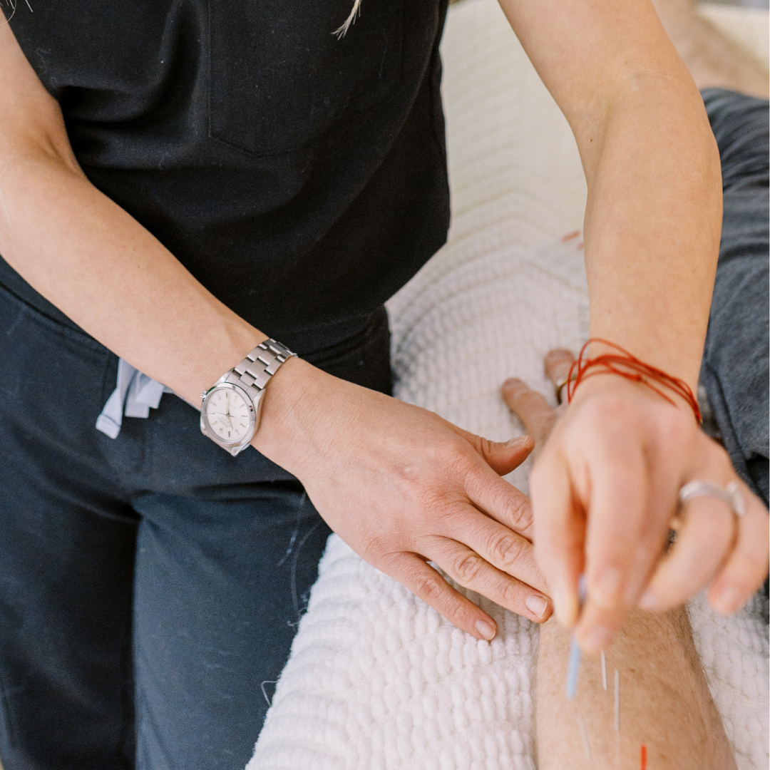 Foundation in Acupuncture (Level 2)