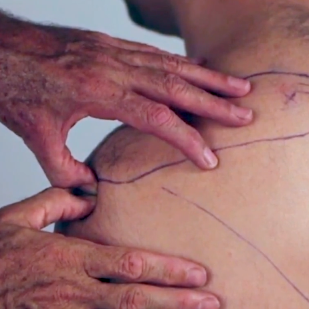 NAT Treating the Rotator Cuff (4 hrs)