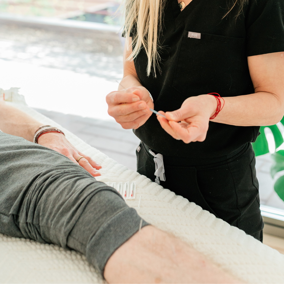 Foundation in Acupuncture (Level 1)