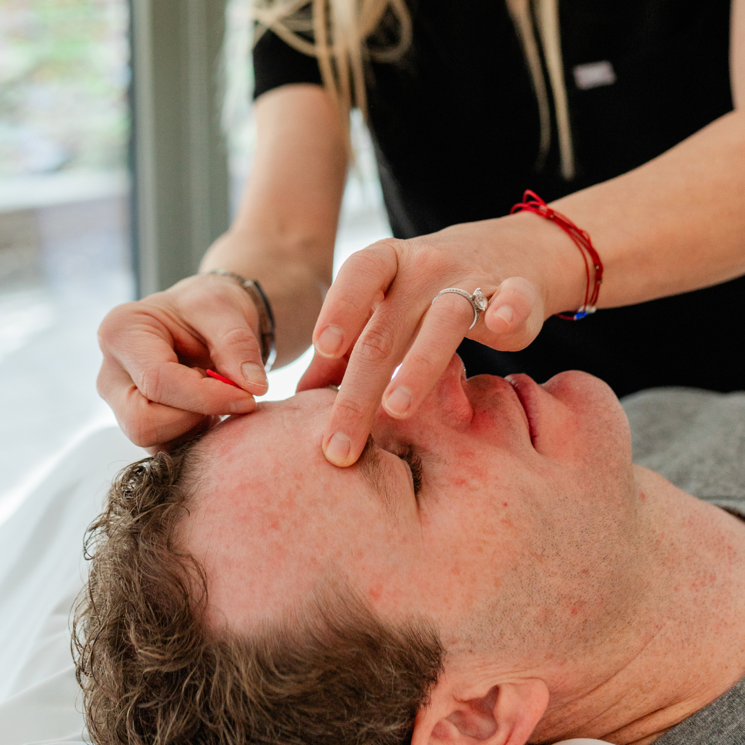 Foundation in Acupuncture (Level 1)