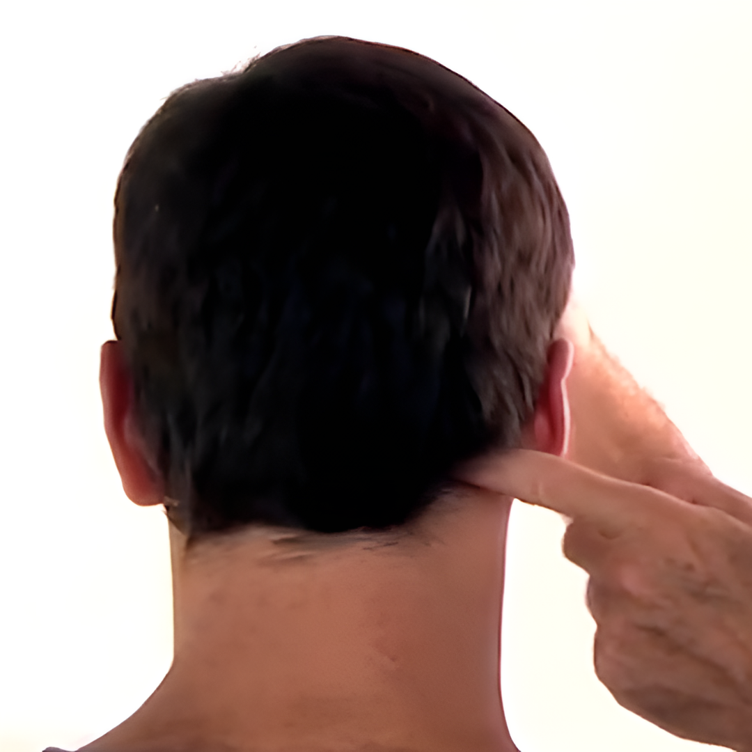 Tension Headache and Trigger Points (4 hrs)