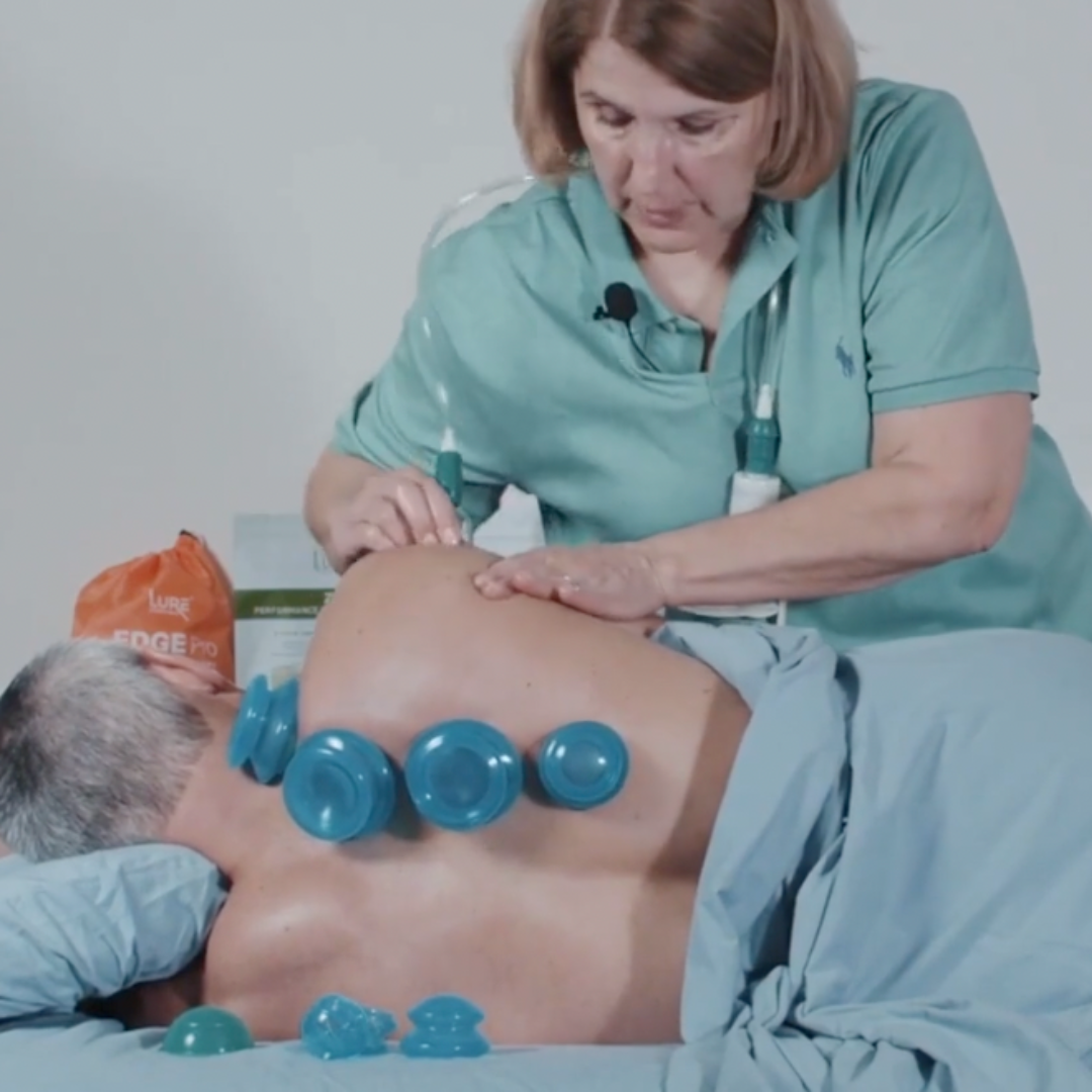 Cupping for the Modern Practitioner (3.5 hrs)