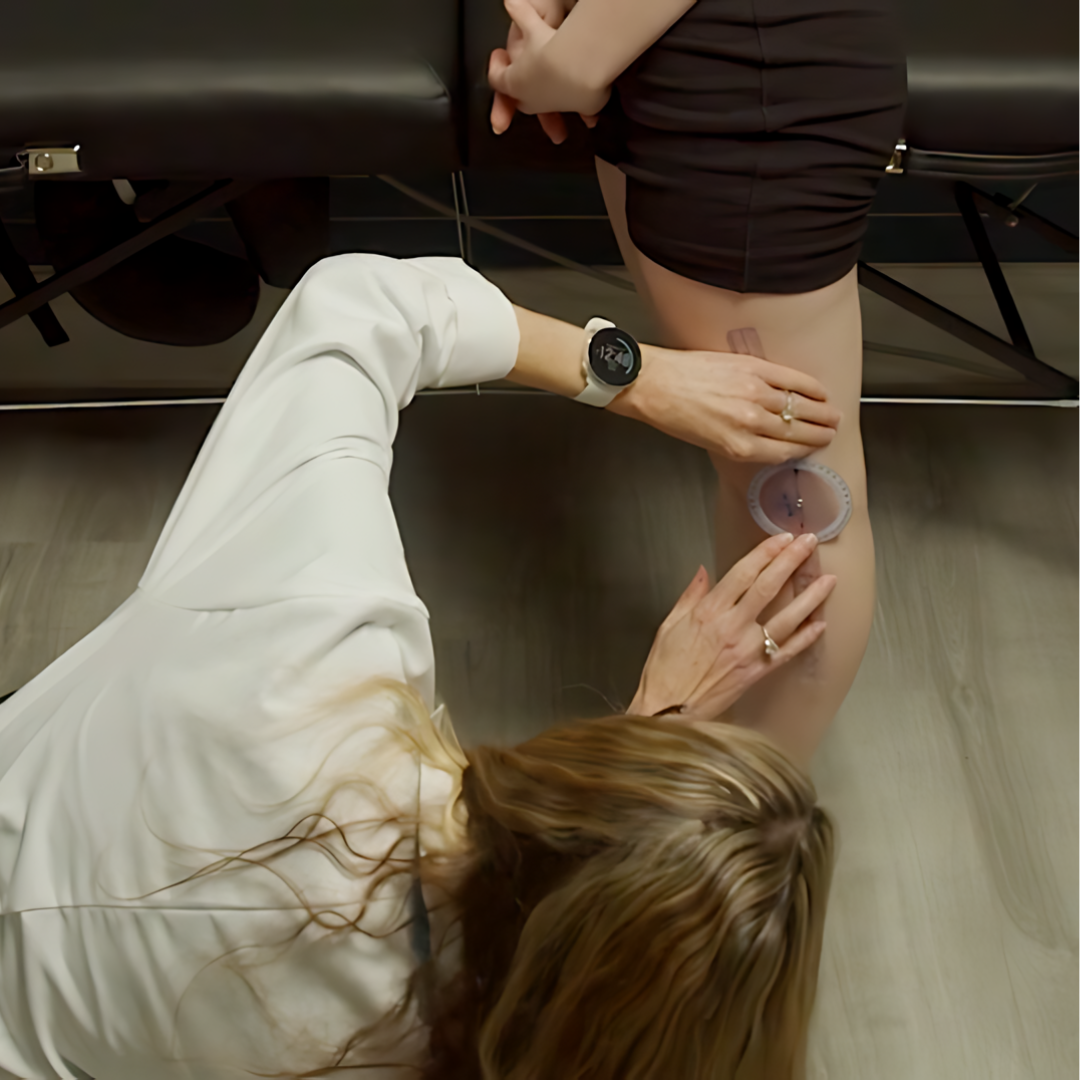 Understanding and Treating Hypermobility (5.5 hrs)