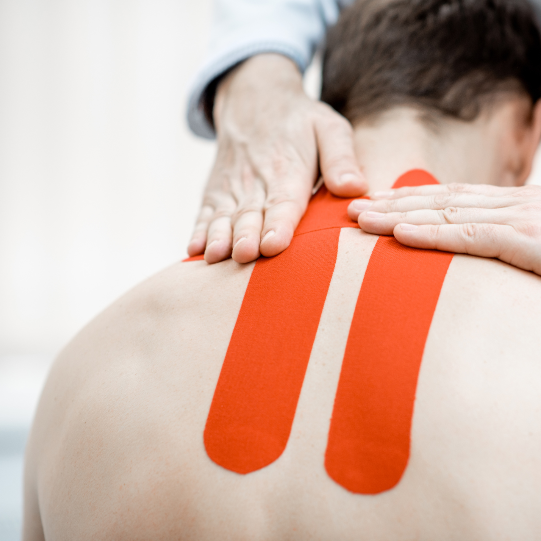 Taping for Trigger Points Online Course