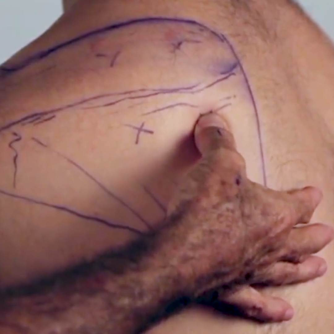 NAT Treating the Rotator Cuff (4 hrs)