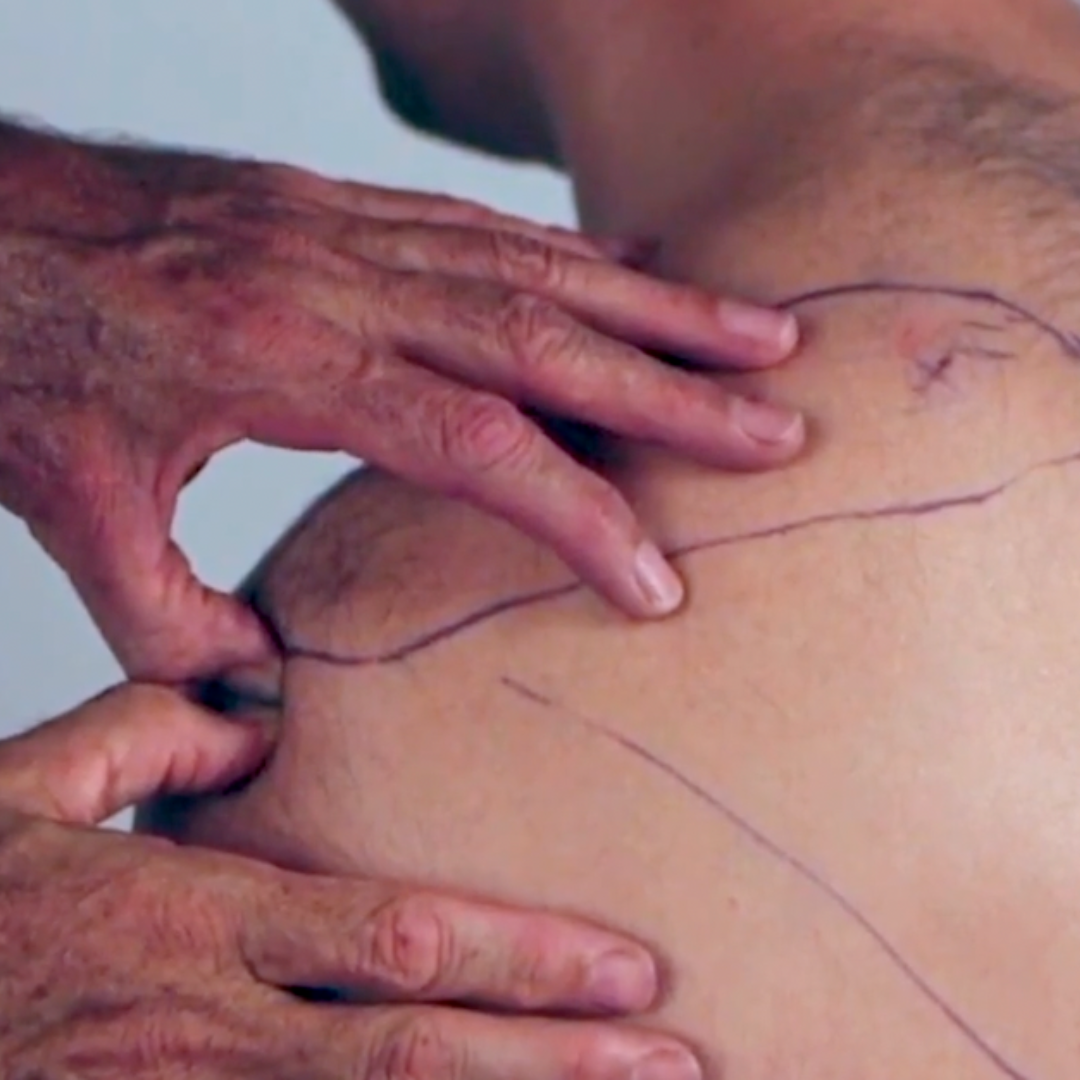 NAT Treating the Rotator Cuff (4 hrs)