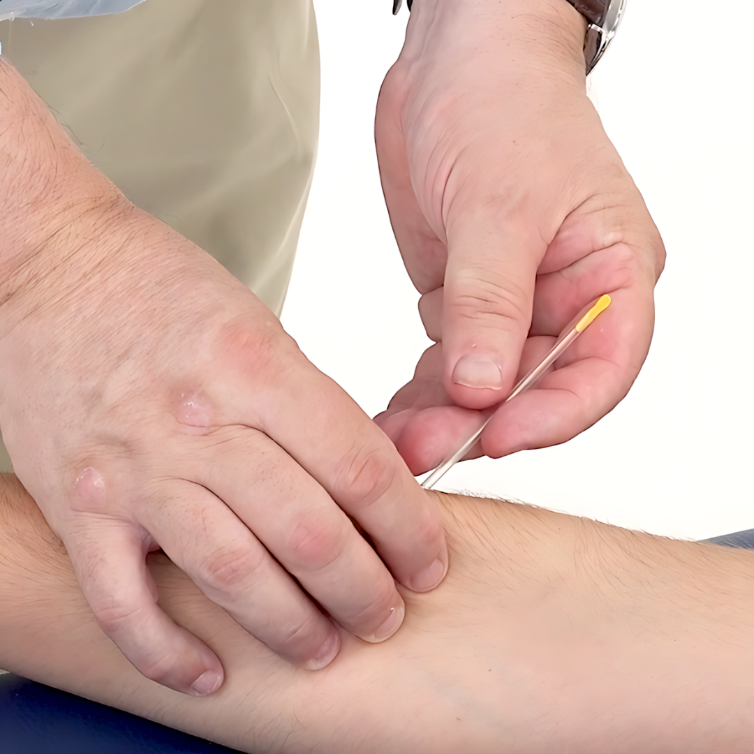 Trigger Point Dry Needling - IMS (18 hrs)