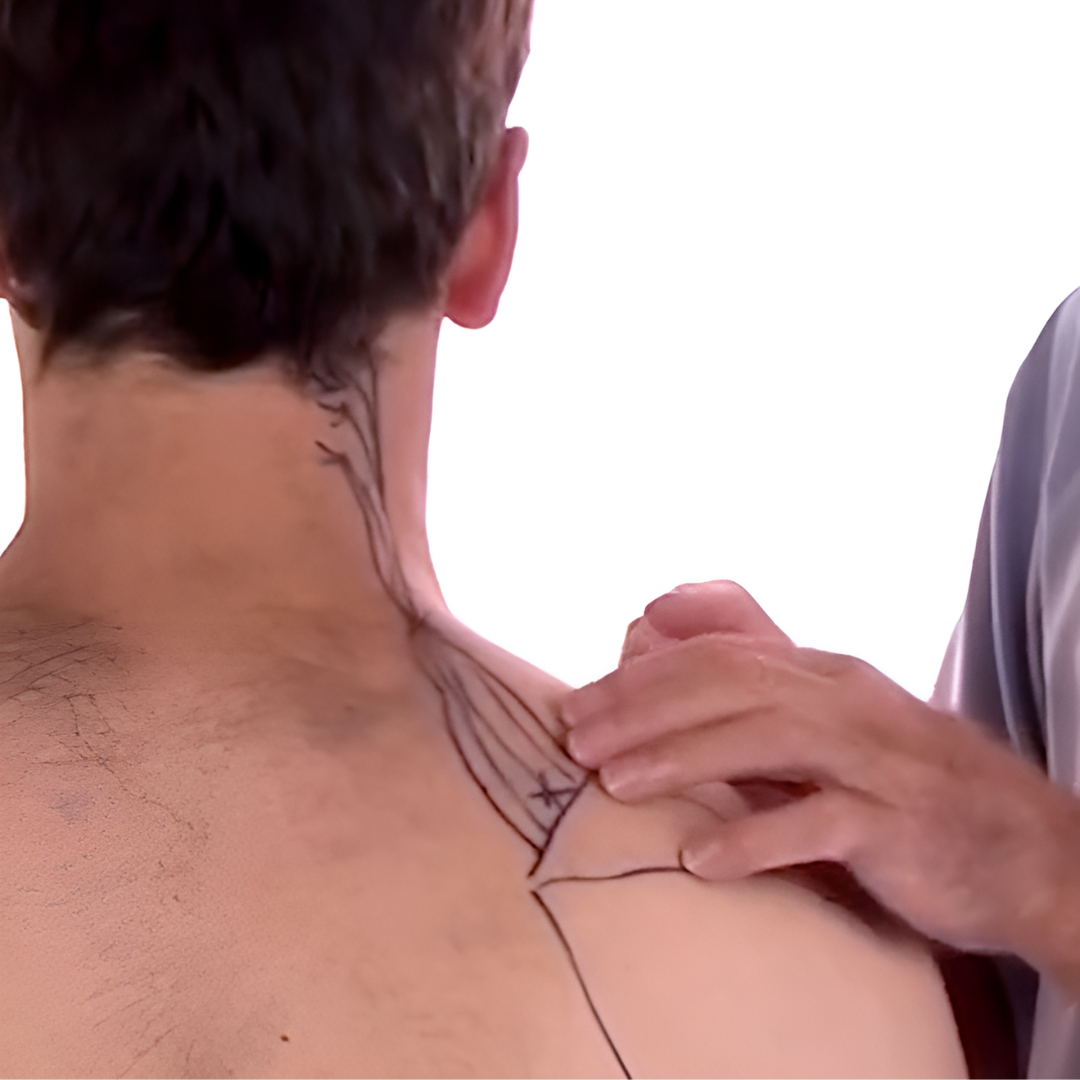 Tension Headache and Trigger Points (4 hrs)