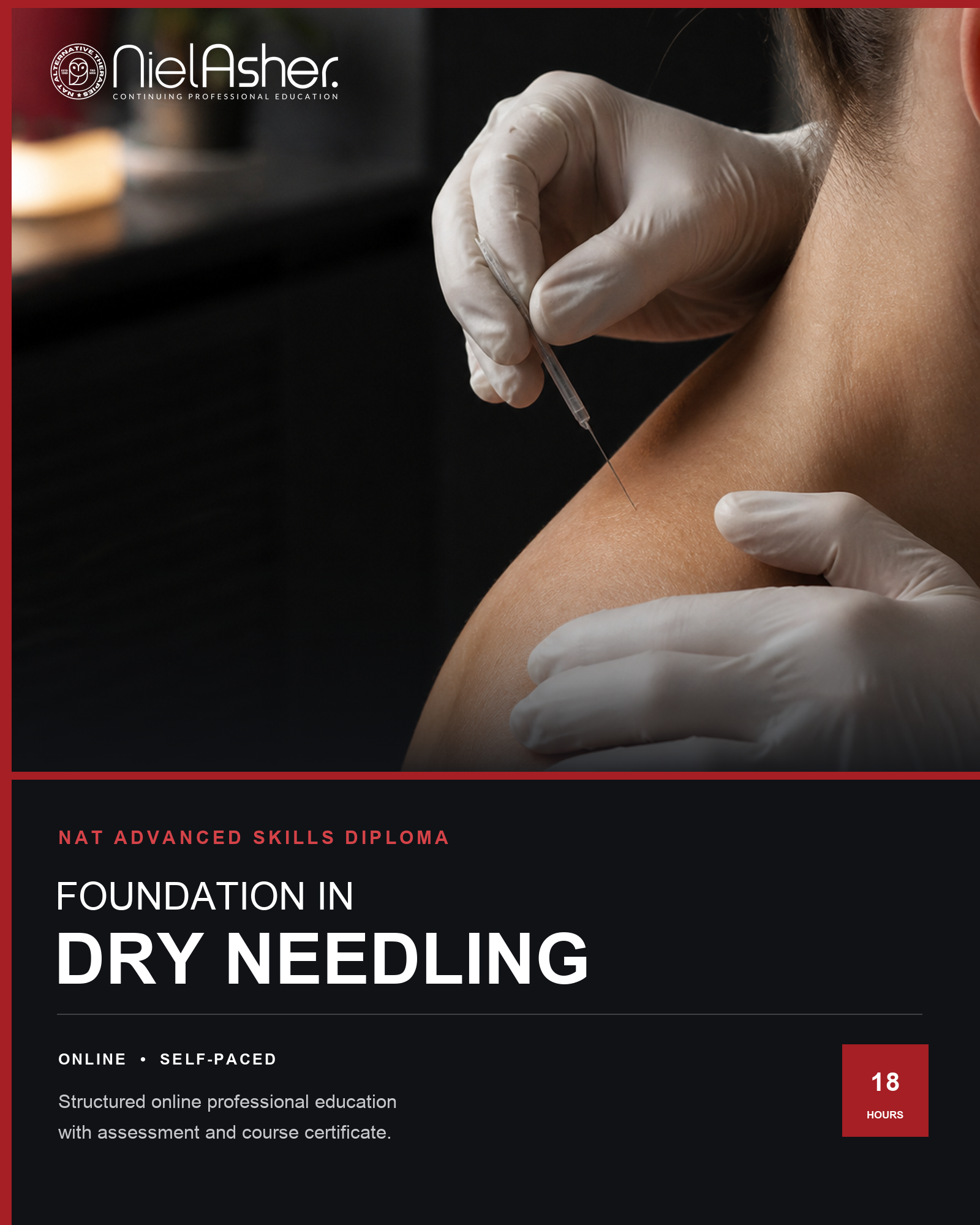 Online Dry Needling Diploma Course