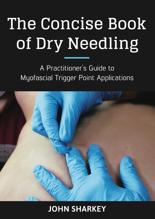 The Concise Book of Dry Needling