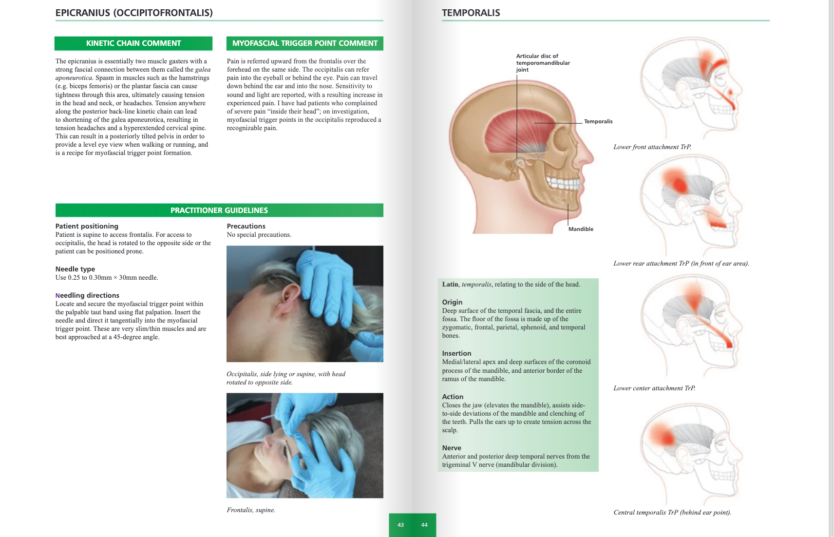The Concise Book of Dry Needling