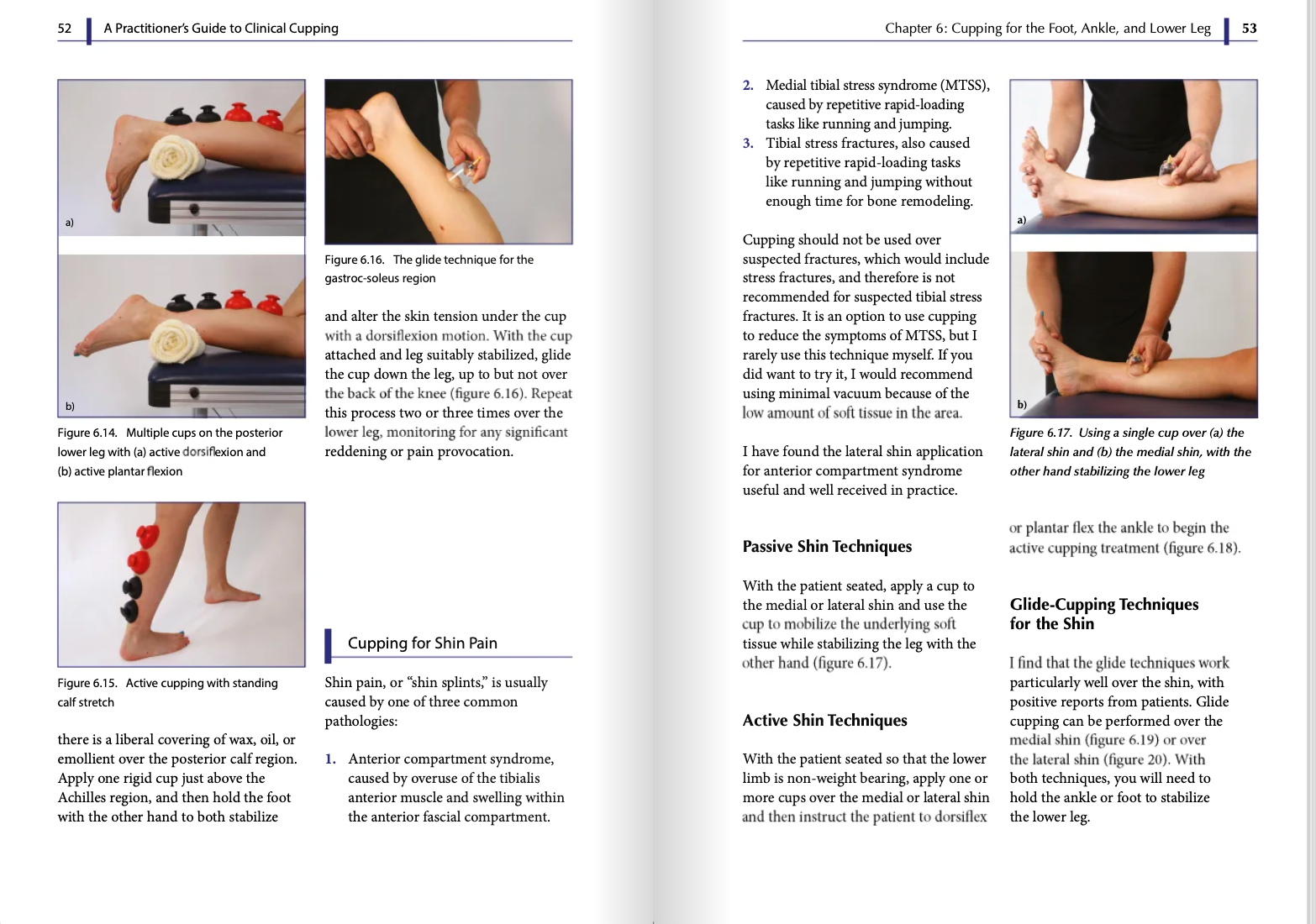 A Practitioner's Guide to Clinical Cupping