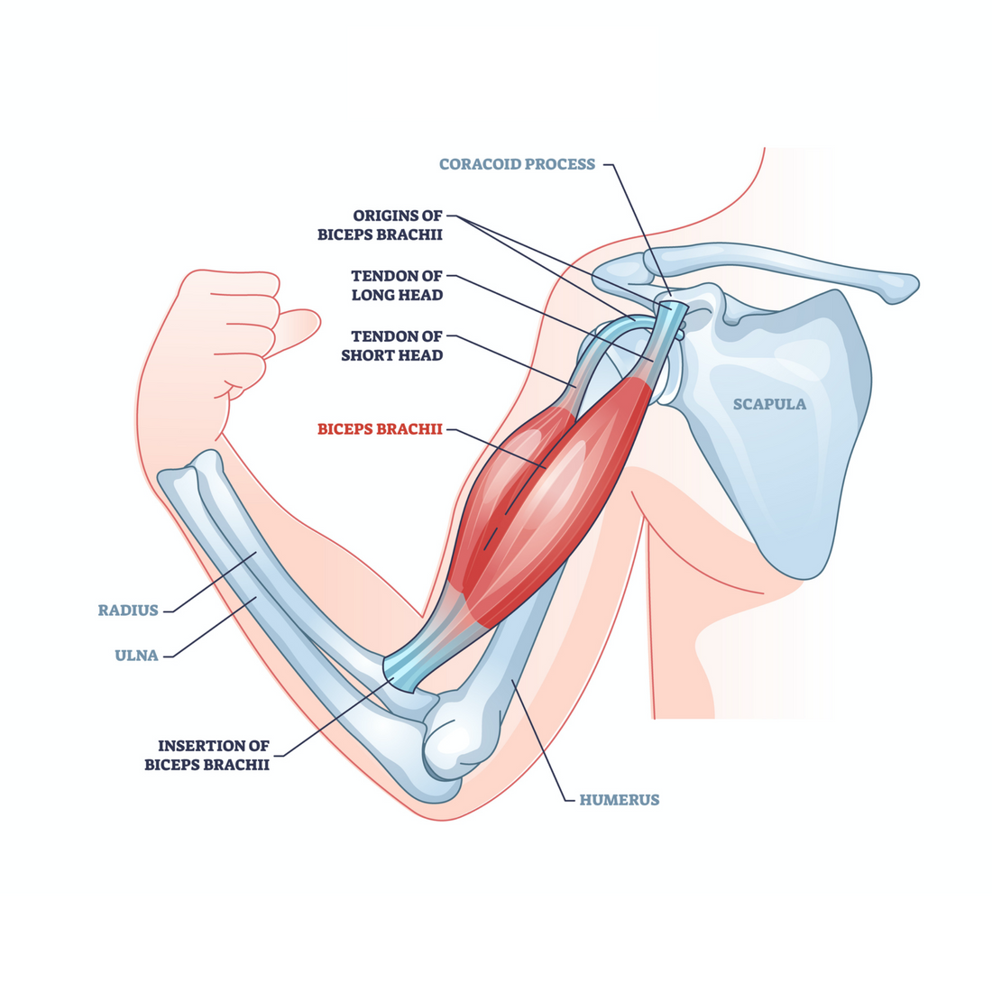 Trigger Point Release - Biceps/Pec Minor Muscle Strain