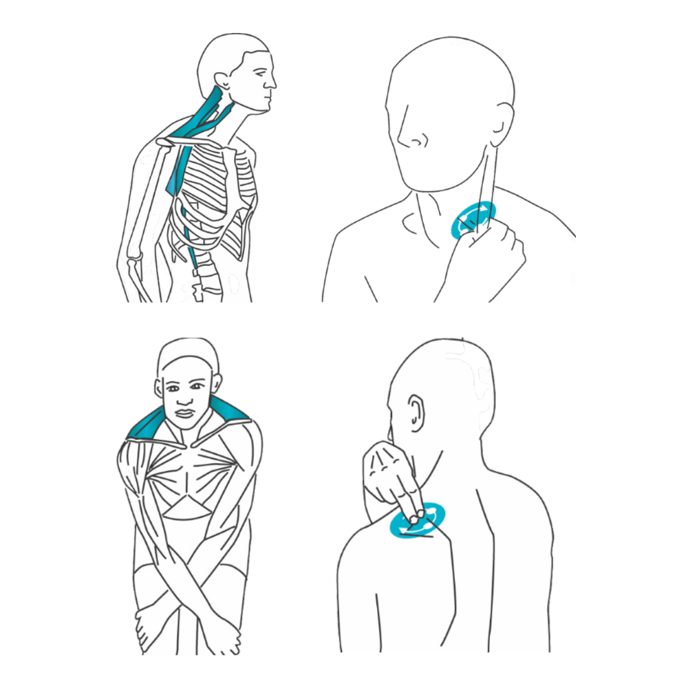 Your Quick Guide for Effective Stiff Neck Treatment