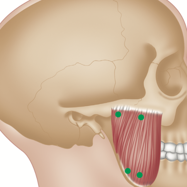 How to Stretch the Masseter Muscle