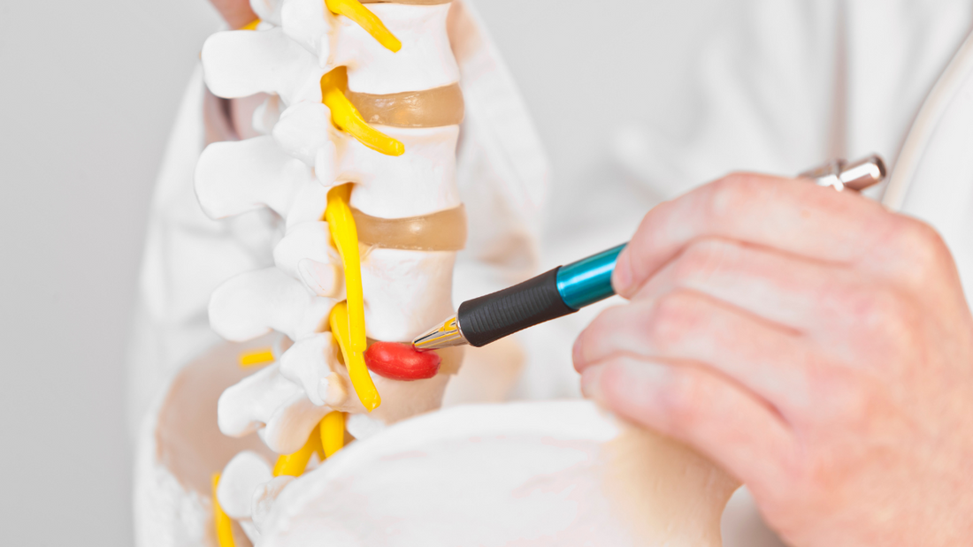 Common Back Pain - Disc Prolapse (Slipped/Ruptured/Herniated Disc)