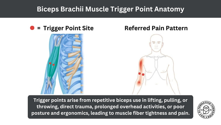 Trigger Point Therapy for Painful and Tight Biceps - Niel Asher Education