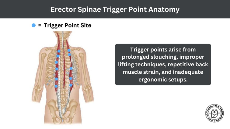 Trigger Point Therapy - Erector Spinae - Niel Asher Education