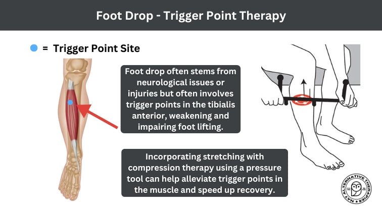 Trigger Point Therapy - Foot Drop Treatment - Niel Asher Education