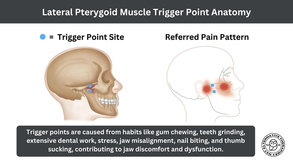 Trigger Points in the Lateral Pterygoid | Head and Jaw Pain - Niel Asher Education