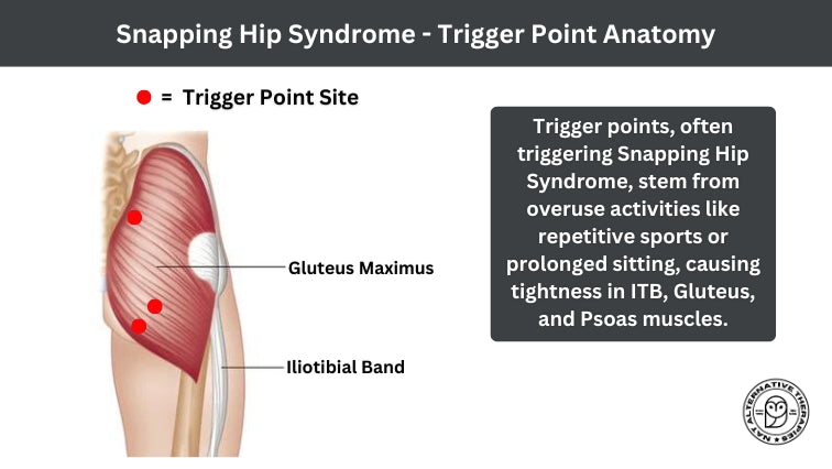 Trigger Point Therapy - Snapping Hip Syndrome - Niel Asher Education