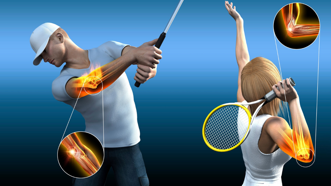 Golfer’s Elbow: What It Is, Why It Happens, and How to Treat It