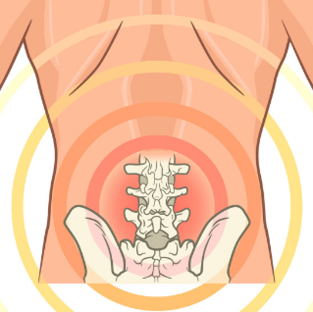 Lumbar Back Pain | Overview | Clinical Assessment - Niel Asher Education