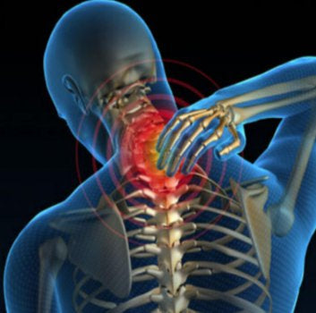 Trigger Point Therapy | Treating the Scalenes | Release Techniques - Niel Asher Education
