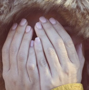 Small Muscles of the hand - How to treat "triggers"?