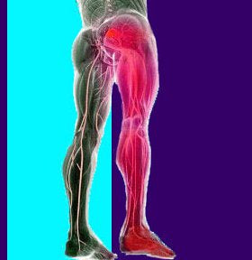 Trigger Point Therapy - Piriformis Syndrome - Niel Asher Education