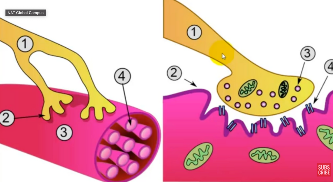Neuroplastic Trigger Point Hypothesis