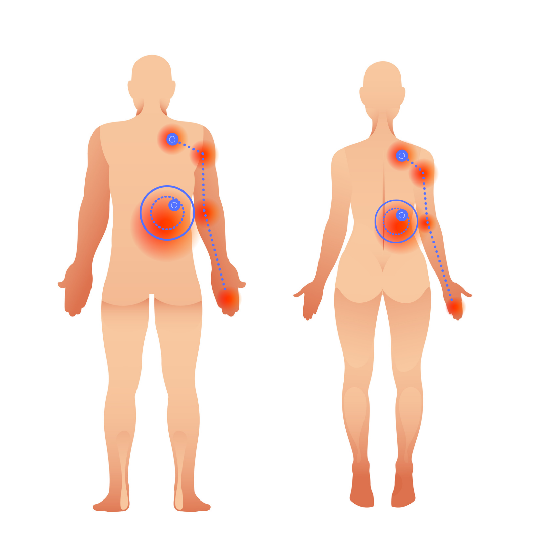 Serratus Posterior Superior | Serratus Posterior Inferior | Shoulder Pain | Back Pain - Niel Asher Education