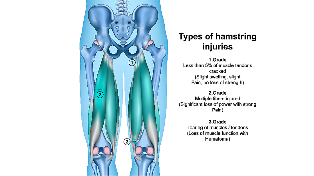 Treating the Hamstring Muscles - Niel Asher Education