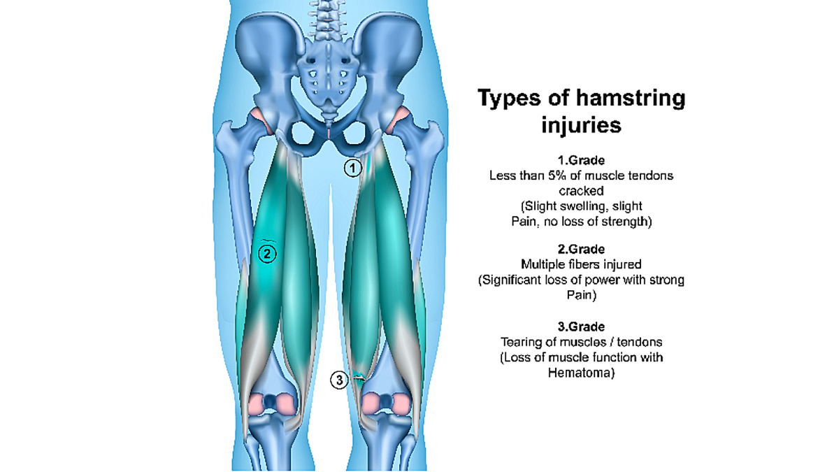 Treating the Hamstring Muscles - Niel Asher Education