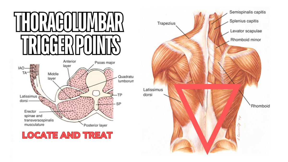 Understanding Trigger Points in the Thoracolumbar Region - Niel Asher Education
