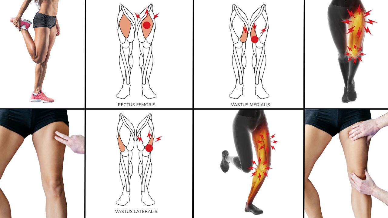 Quadriceps Trigger Point Release