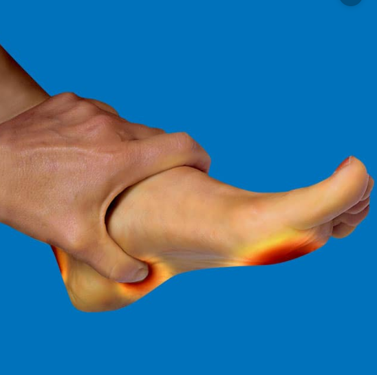 Trigger Point Therapy - Superficial Muscles of the Foot - Niel Asher Education