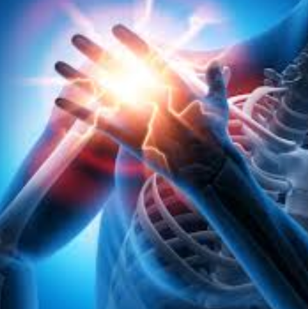 Frozen Shoulder and Diabetes - Niel Asher Education