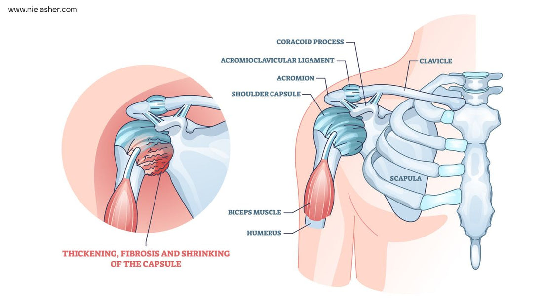 Massage Therapy for Frozen Shoulder - Niel Asher Education