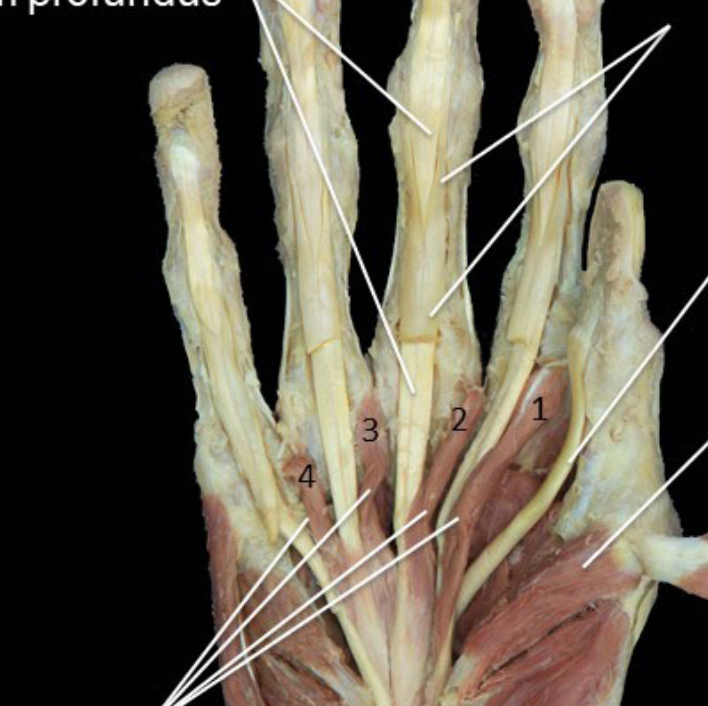 Trigger Point Therapy - Intrinsic Hand Muscles | Hand & Fingers, Thumb ...