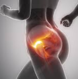 Treatment For Hip Bursitis and Causes Melbourne