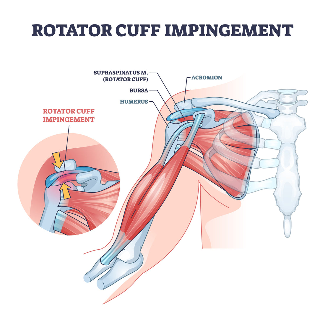 Supraspinatus | Anatomy | Trigger Point Release - Niel Asher Education