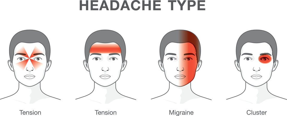 Treating Tension Headaches - Trigger Point Therapy - Niel Asher Education