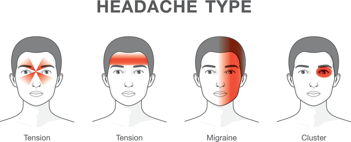 Treating Tension Headaches - Trigger Point Therapy - Niel Asher Education