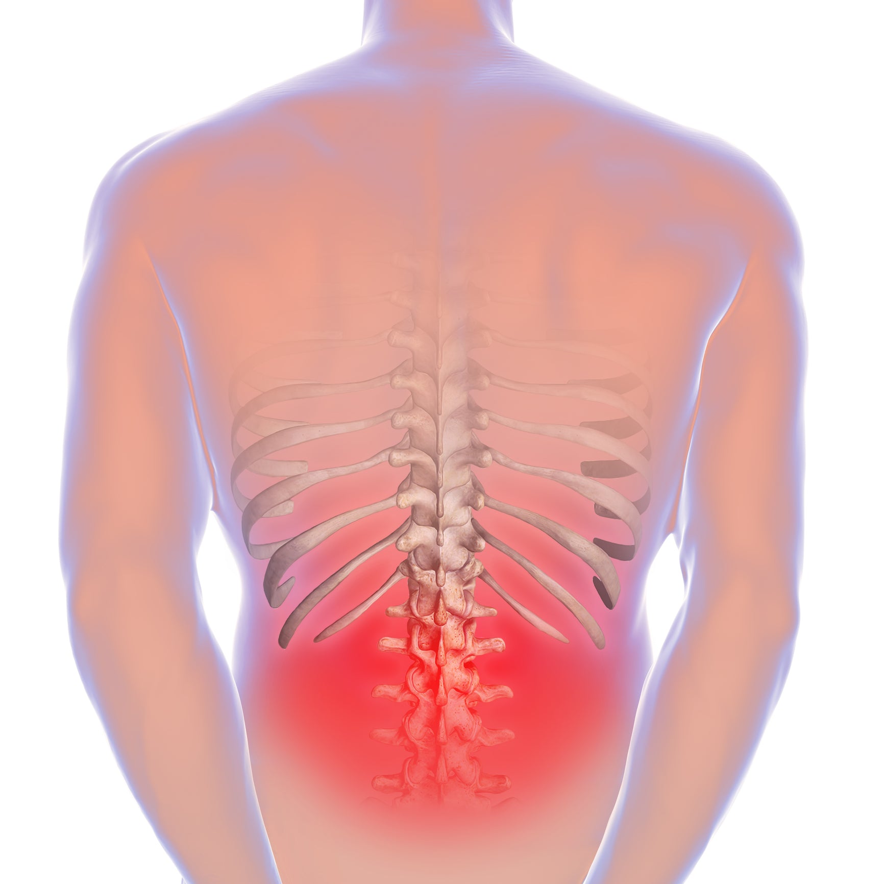 How to Treat Low Back Pain